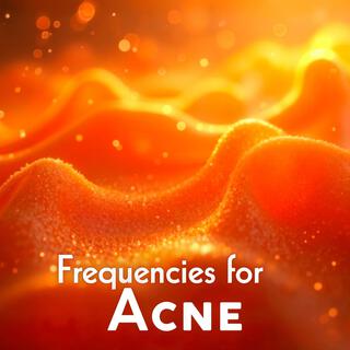 Skin Health: Healing Frequencies for Acne Treatment