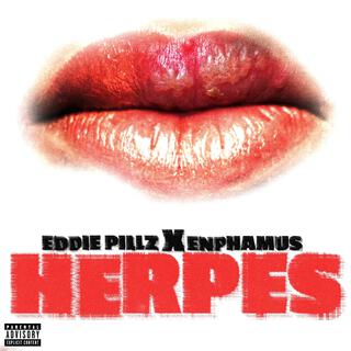 Herpes