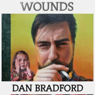 WOUNDS