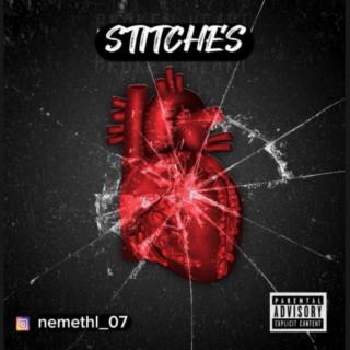 Stitches