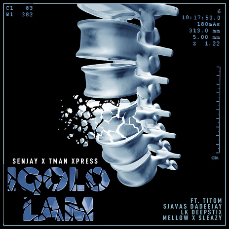 Iqolo Lam (feat. Mellow & Sleazy, SjavasDaDeejay, TitoM, LK Deepstix) | Boomplay Music