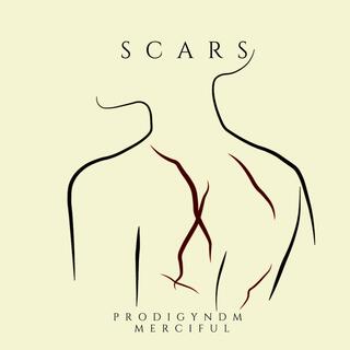 Scars