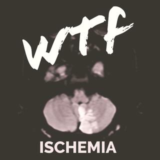 Ischemia