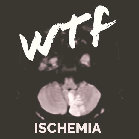 Ischemia | Boomplay Music