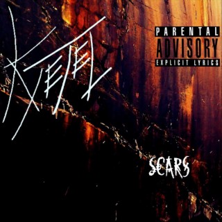 Scars