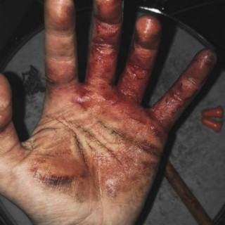 The Bloody Hand