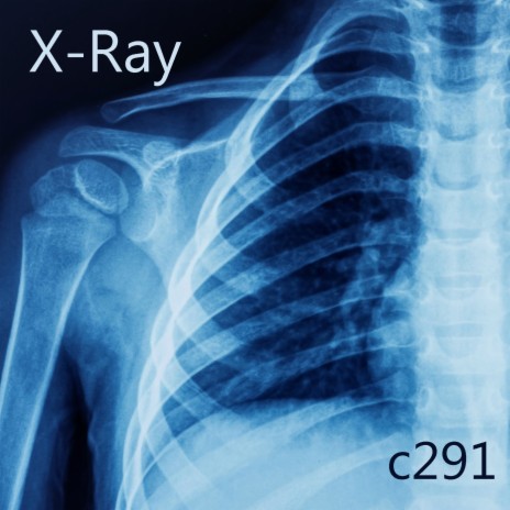 X-ray | Boomplay Music