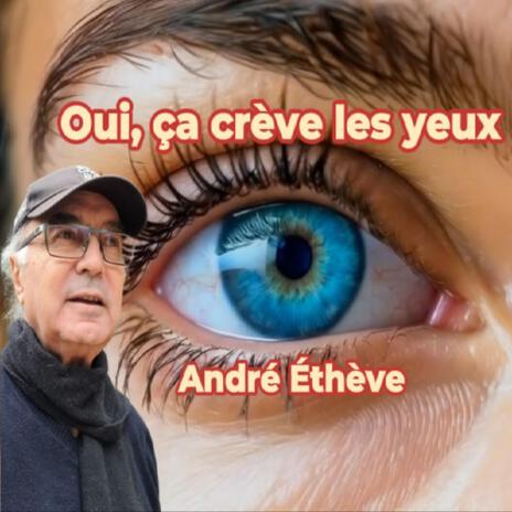 Oui, ça crève les yeux