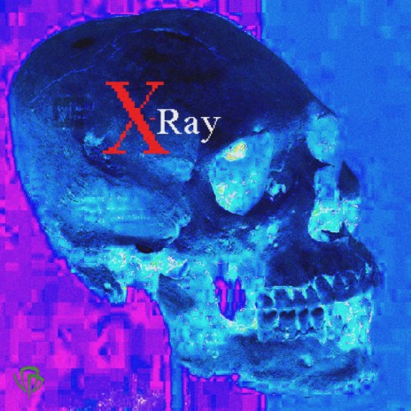 X-Ray | Boomplay Music