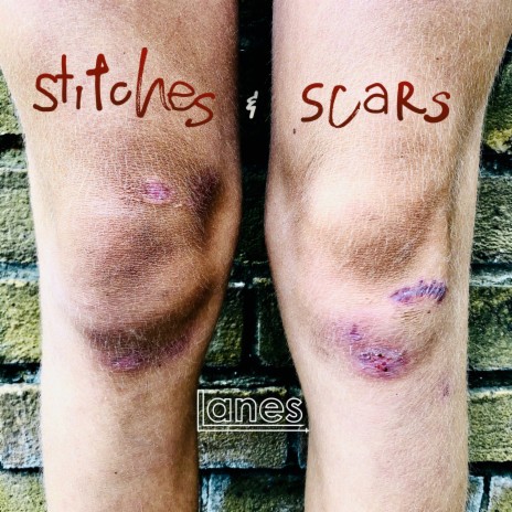 Stitches & Scars | Boomplay Music