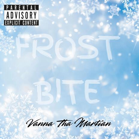 Frostbite | Boomplay Music