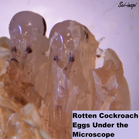 Rotten Cockroach Eggs Under the Microscope | Boomplay Music