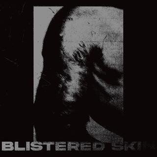 Blistered Skin