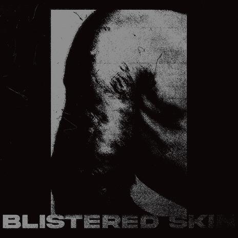 Blistered Skin | Boomplay Music