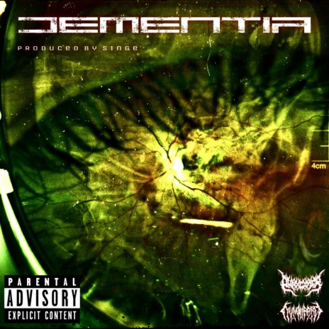 Dementia ft. Yung Rare | Boomplay Music