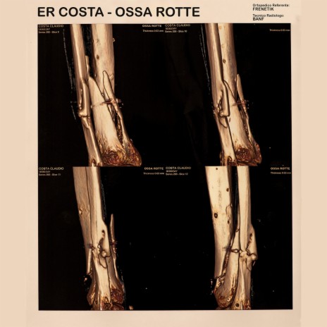 Ossa rotte | Boomplay Music