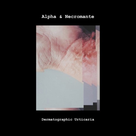 Dematographic Urticaria (Original Mix) ft. Necromante | Boomplay Music